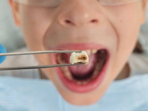 Best Emergency Treatment for Toothache in Terre Hill, PA